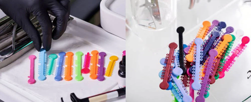 dental ligature applications
